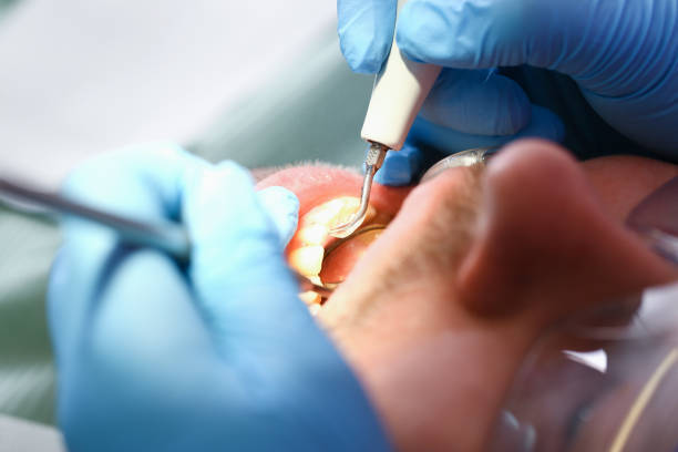 Best Emergency Dentist for Knocked-Out Tooth in Terra Alta, WV