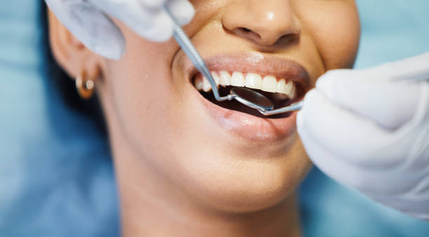Best Emergency Dentist for Lost Fillings or Crowns in Terra Alta, WV