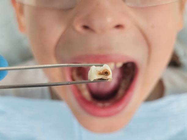 Best Emergency Dental Services for Seniors in Terra Alta, WV